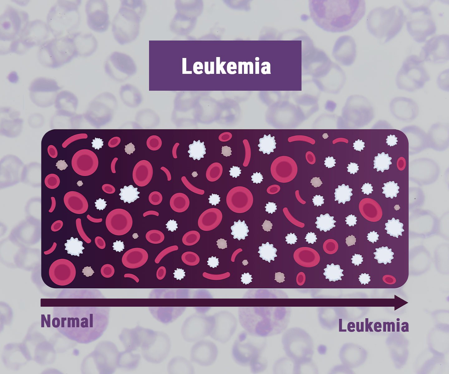 Leukémie