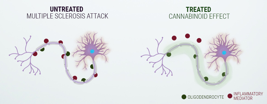 USING CANNABIS AGAINST MULTIPLE SCLEROSIS USING CANNABIS AGAINST MULTIPLE SCLEROSIS